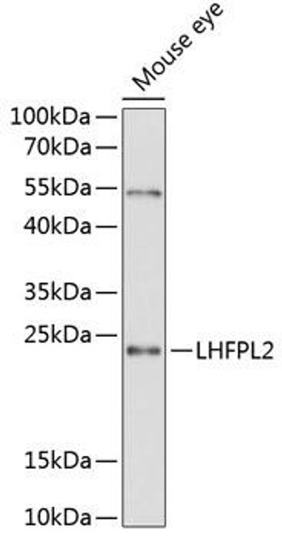 Anti-LHFPL2 Antibody (CAB12873)