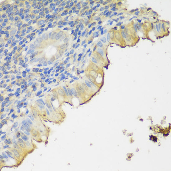 Anti-CLN5 Antibody (CAB12886)