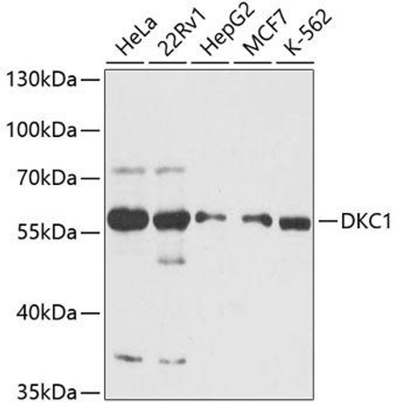 Anti-DKC1 Antibody (CAB12914)