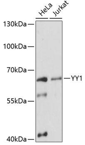 Anti-YY1 Antibody (CAB12928)