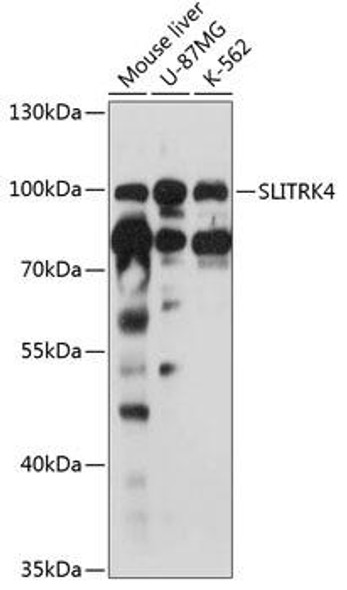 Anti-SLITRK4 Antibody (CAB12936)