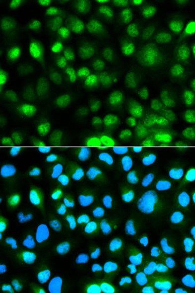 Anti-Ataxin 3 Antibody (CAB12992)