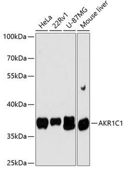 Anti-AKR1C1 Antibody (CAB13004)