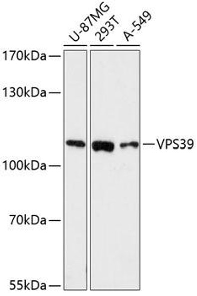 Anti-VPS39 Antibody (CAB13082)