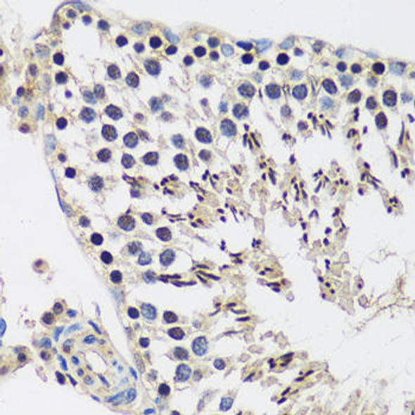 Anti-CASC5 Antibody (CAB13108)