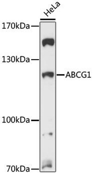 Anti-ABCG1 Antibody (CAB13158)