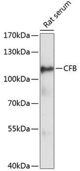 Anti-CFB Antibody (CAB13243)