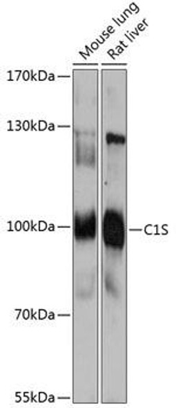 Anti-C1S Antibody (CAB13282)