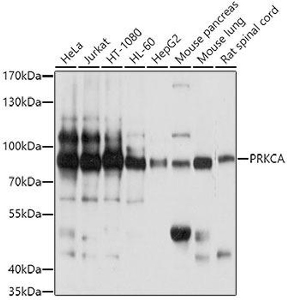 Anti-PRKCA Antibody (CAB13342)