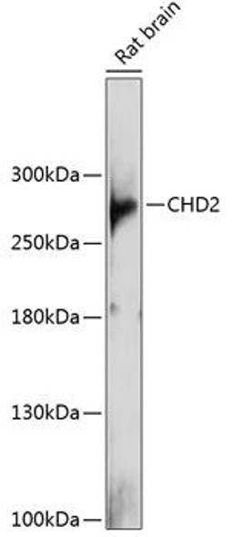 Anti-CHD2 Antibody (CAB13477)