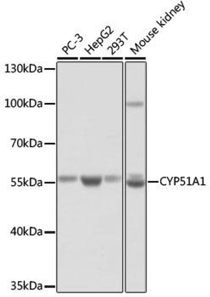 Anti-CYP51A1 Antibody (CAB13485)
