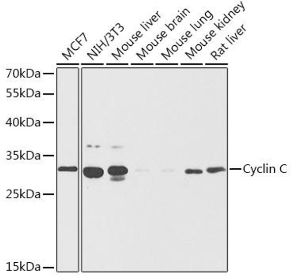 Anti-Cyclin C Antibody (CAB13610)