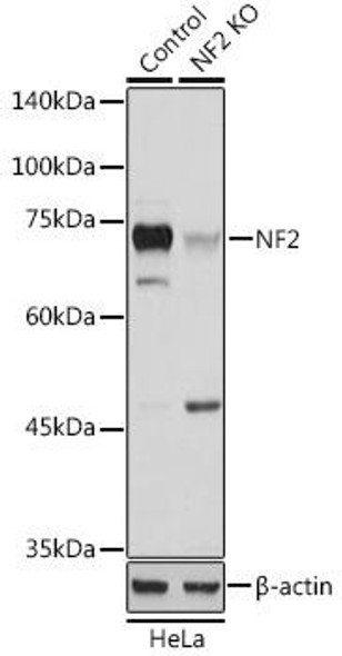 Anti-NF2 Antibody (CAB13626)[KO Validated]