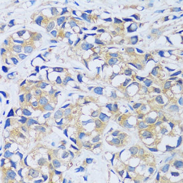 Anti-CABP7 Antibody (CAB13703)