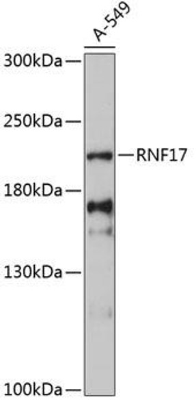 Anti-RNF17 Antibody (CAB13813)