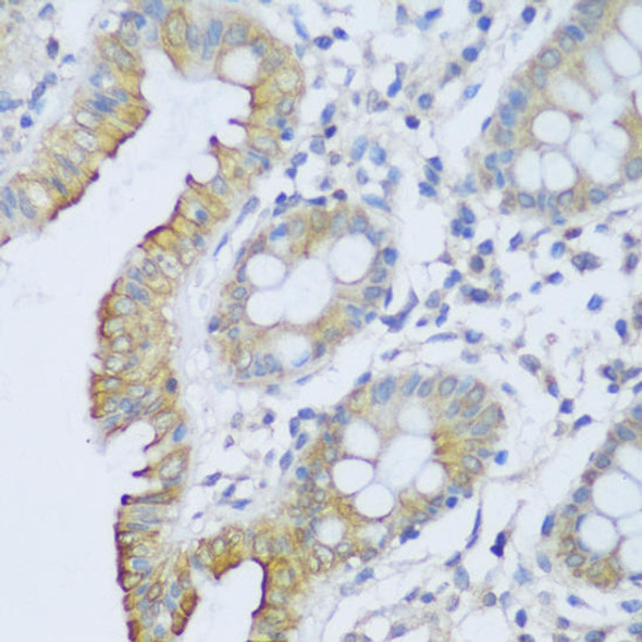 Anti-CRACR2A Antibody (CAB13838)