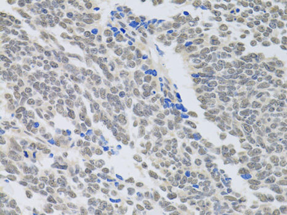 Anti-PAX3 Antibody (CAB13930)