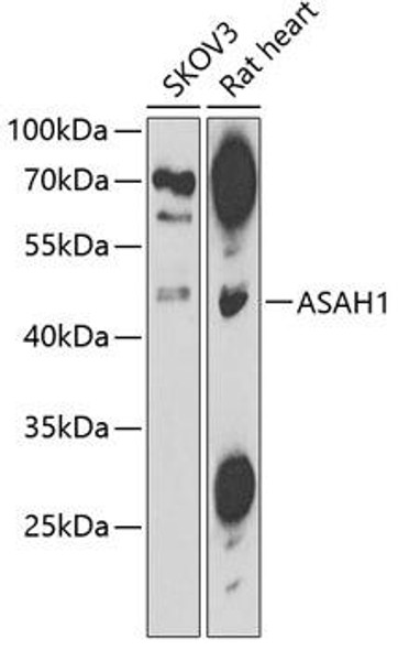 Anti-ASAH1 Antibody (CAB13948)