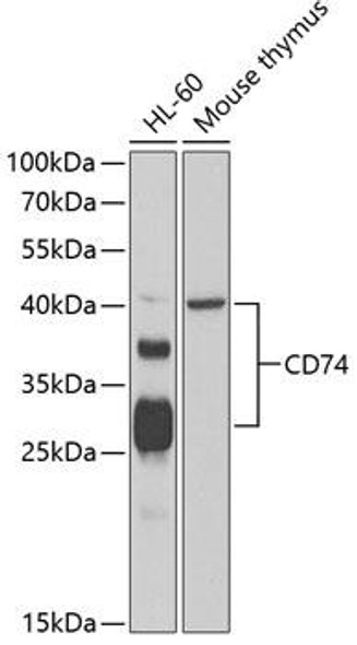 Anti-CD74 Antibody (CAB13958)