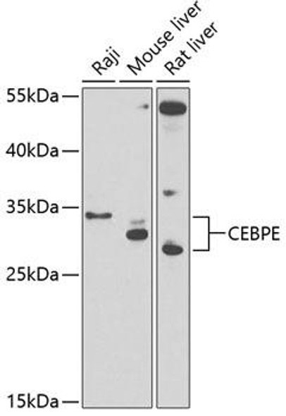 Anti-CEBPE Antibody (CAB13960)