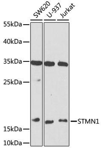 Anti-STMN1 Antibody (CAB14018)