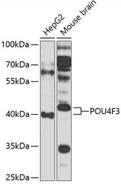 Anti-POU4F3 Antibody (CAB14049)