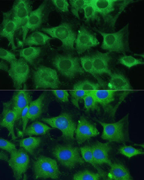 Anti-PTPN22 Antibody (CAB1406)