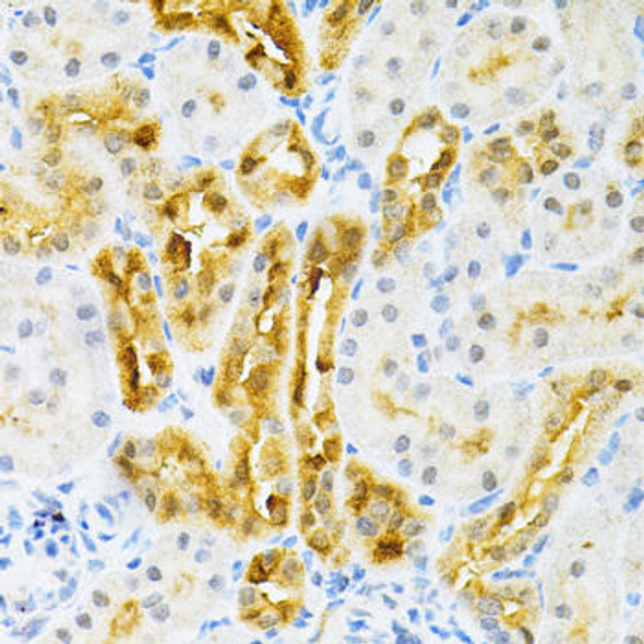 Anti-SULT2A1 Antibody (CAB14063)