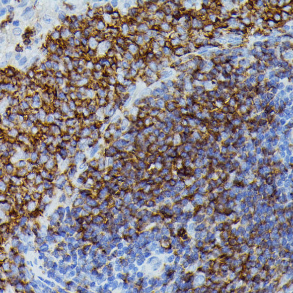 Anti-APOC3 Antibody (CAB1409)