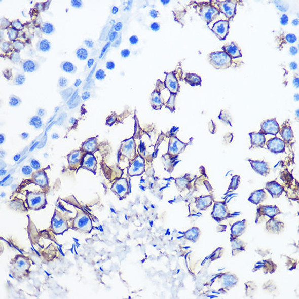 Anti-SLC6A4 Antibody (CAB14171)