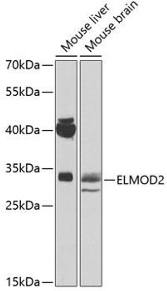 Anti-ELMOD2 Antibody (CAB14205)