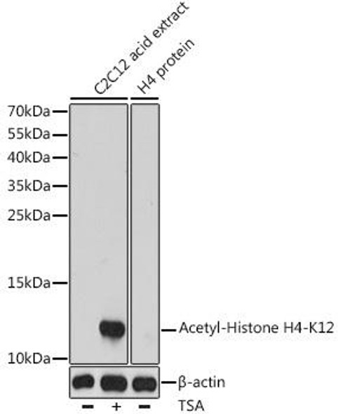 Anti-Acetyl-Histone H4-K12 Antibody (CAB14227)