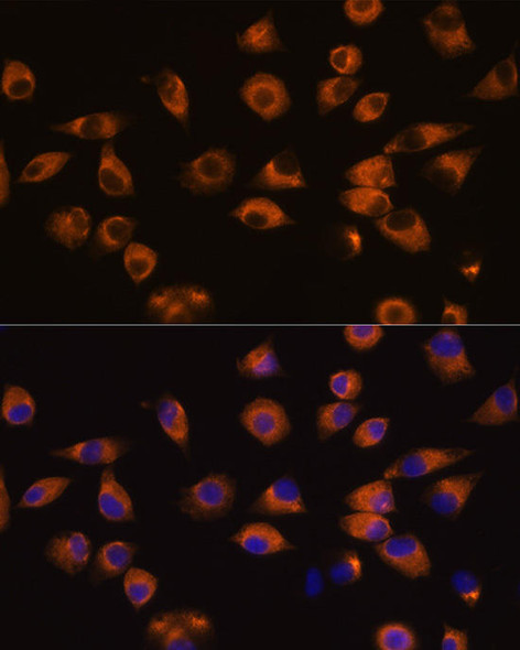 Anti-EPHA5 Antibody (CAB14238)