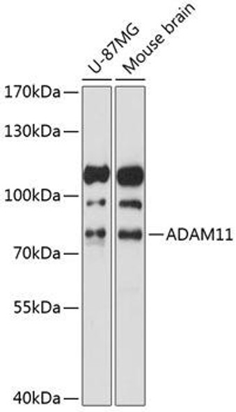 Anti-ADAM11 Antibody (CAB14249)