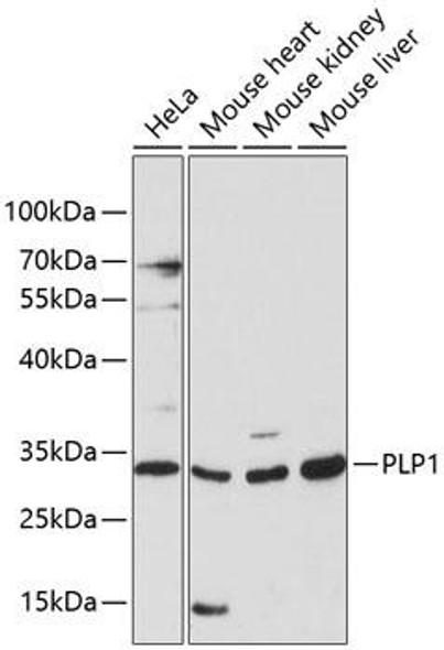 Anti-PLP1 Antibody (CAB14251)
