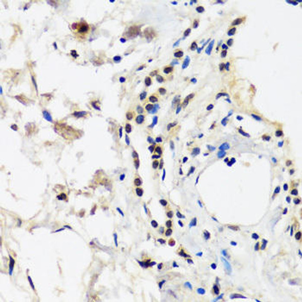 Anti-CAND1 Antibody (CAB14287)