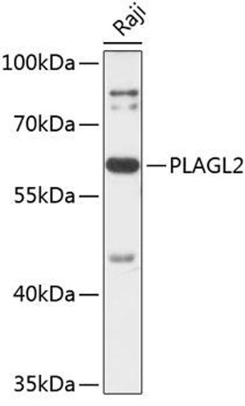 Anti-PLAGL2 Antibody (CAB14318)