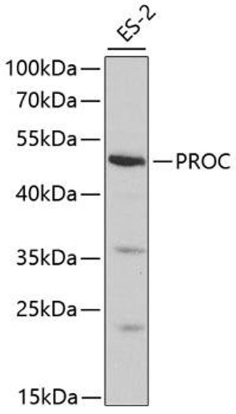 Anti-PROC Antibody (CAB1432)