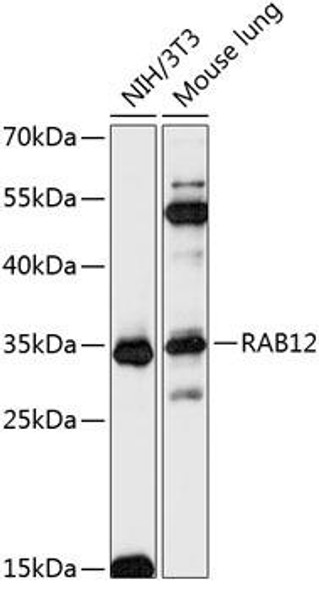 Anti-RAB12 Antibody (CAB14320)