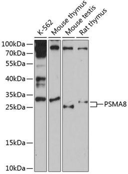 Anti-PSMA8 Antibody (CAB14365)