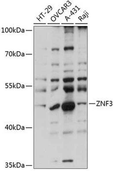 Anti-ZNF3 Antibody (CAB14382)
