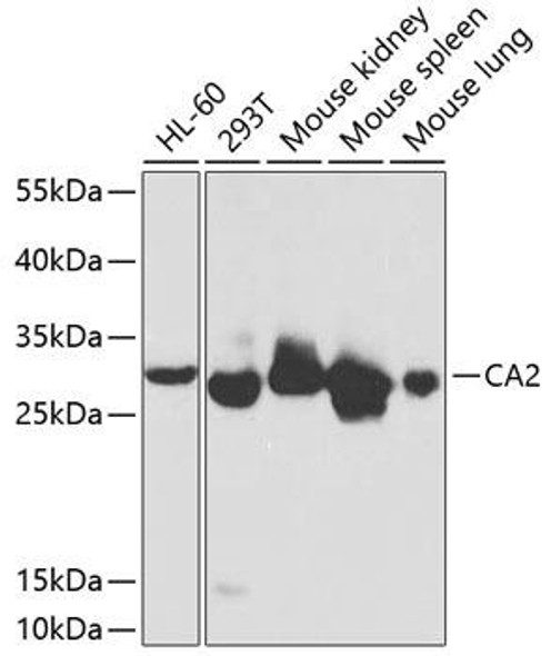 Anti-CA2 Antibody (CAB1440)