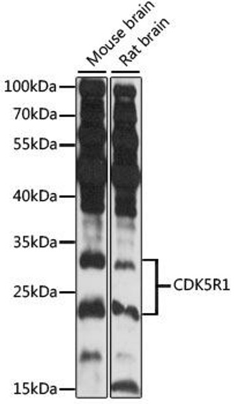 Anti-CDK5R1 Antibody (CAB14497)
