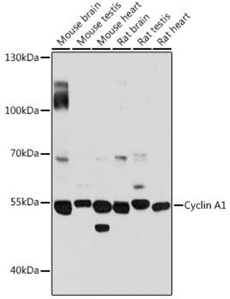 Anti-Cyclin A1 Antibody (CAB14529)