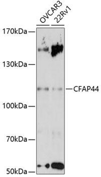 Anti-CFAP44 Antibody (CAB14539)