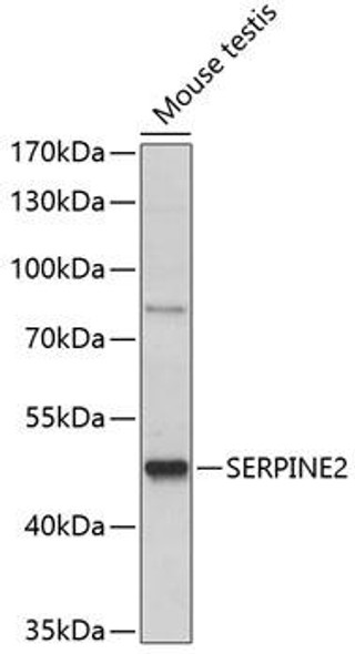 Anti-SERPINE2 Antibody (CAB14540)