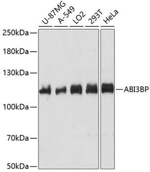 Anti-ABI3BP Antibody (CAB14581)
