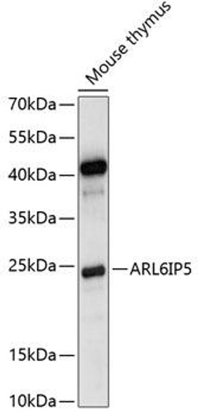 Anti-ARL6IP5 Antibody (CAB14842)