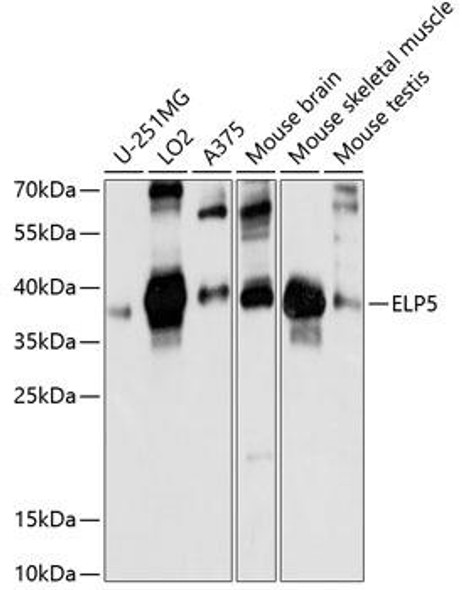 Anti-ELP5 Antibody (CAB14862)