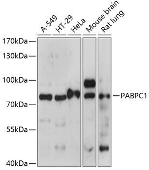 Anti-Polyclonal AntibodyPC1 Antibody (CAB14872)